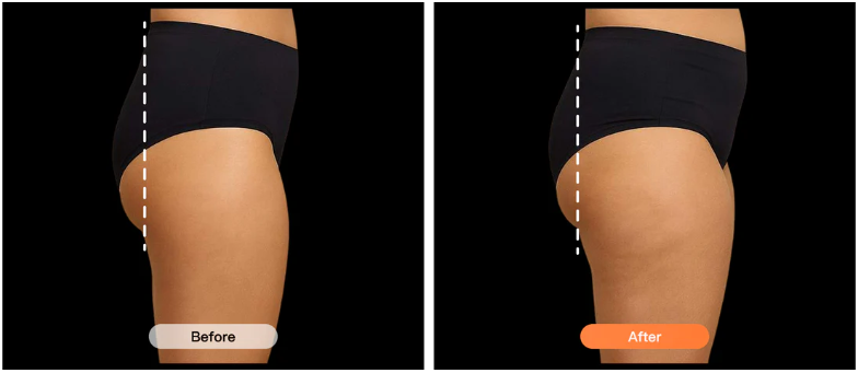 Before and after results showing rounder curves and body shaping after using Lumo EMS pants