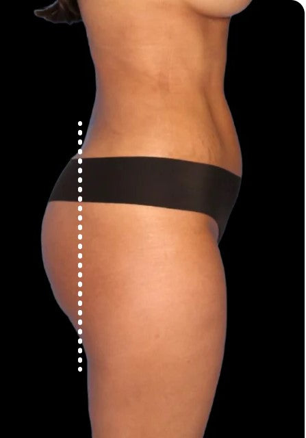 Side body profile of client after using Lumo EMS pants showing toned and shaped results